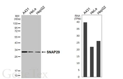 Anti-SNAP29 antibody [HL3232] used in Western Blot (WB). GTX640873
