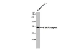Anti-FSH Receptor antibody [HL3233] used in Western Blot (WB). GTX640874