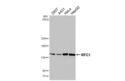 Anti-RFC1 antibody [HL3242] used in Western Blot (WB). GTX640885