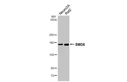 Anti-SMG6 antibody [HL3274] used in Western Blot (WB). GTX640928