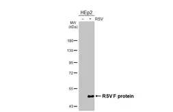 Anti-Respiratory Syncytial virus Fusion protein antibody [GT19] used in Western Blot (WB). GTX640950