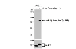 Anti-SHP2 (phospho Tyr542) antibody [HL3334] used in Western Blot (WB). GTX641099