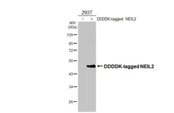 Anti-NEIL2 antibody [HL3343] used in Western Blot (WB). GTX641115