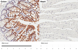 Anti-IL1 Receptor antagonist antibody [HL3369] used in IHC (Paraffin sections) (IHC-P). GTX641189