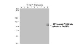 Anti-PKC theta (phospho Ser695) antibody [HL3396] used in Western Blot (WB). GTX641233