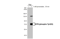 Anti-BTK (phospho Tyr223) antibody [HL3403] used in Western Blot (WB). GTX641240