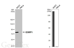 Anti-ESRP1 antibody [HL3413] used in Western Blot (WB). GTX641250