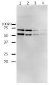 Anti-HIV1 Reverse transcriptase antibody used in Western Blot (WB). GTX64133
