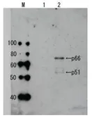 Anti-HIV1 Reverse transcriptase antibody used in Western Blot (WB). GTX64133