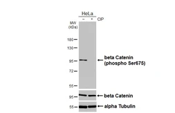 Anti-beta Catenin (phospho Ser675) antibody [HL3471] used in Western Blot (WB). GTX641356