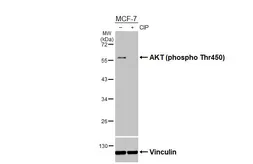Anti-AKT (phospho Thr450) antibody [HL3478] used in Western Blot (WB). GTX641363