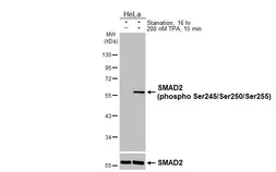 Anti-SMAD2 (phospho Ser245/Ser250/Ser255) antibody [HL3555] used in Western Blot (WB). GTX641461