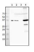 Anti-RecA antibody used in Western Blot (WB). GTX64150
