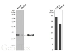 Anti-Rad51 antibody [HL3628] used in Western Blot (WB). GTX641619