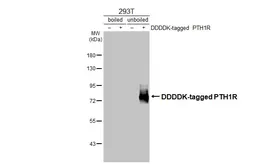 Anti-PTH1R antibody [HL3651] used in Western Blot (WB). GTX641642