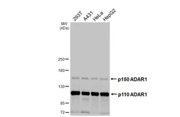 Anti-ADAR1 antibody [HL3666] used in Western Blot (WB). GTX641694