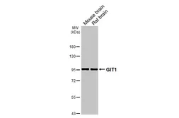 Anti-GIT1 antibody [GT87] used in Western Blot (WB). GTX641942