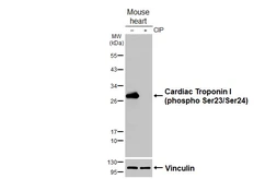 Anti-Cardiac Troponin I (phospho Ser23/Ser24) antibody [HL3796] used in Western Blot (WB). GTX642015