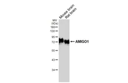 Anti-AMIGO1 antibody [GT94] used in Western Blot (WB). GTX642027