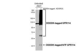 Anti-GPR114 antibody [HL3850] used in Western Blot (WB). GTX642084