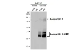 Anti-Latrophilin 1 antibody [HL3853] used in Western Blot (WB). GTX642087