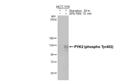 Anti-PYK2 (phospho Tyr402) antibody [HL3860] used in Western Blot (WB). GTX642098