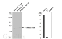 Anti-TSH receptor antibody [HL3874] used in Western Blot (WB). GTX642112