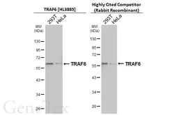Anti-TRAF6 antibody [HL3885] used in Western Blot (WB). GTX642126