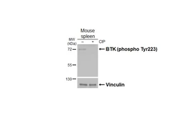 Anti-BTK (phospho Tyr223) antibody [HL3887] used in Western Blot (WB). GTX642128
