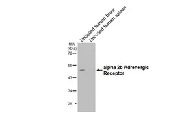 Anti-alpha 2b Adrenergic Receptor antibody [HL3957] used in Western Blot (WB). GTX642207