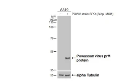 Anti-Powassan virus prM protein antibody [HL4037] used in Western Blot (WB). GTX642368