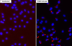 Anti-Powassan virus prM protein antibody [HL4039] used in Immunocytochemistry/ Immunofluorescence (ICC/IF). GTX642370