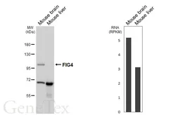 Anti-FIG4 antibody [GT149] used in Western Blot (WB). GTX642486