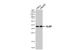 Anti-SLBP antibody [HL4075] used in Western Blot (WB). GTX642514