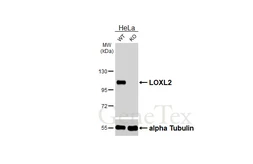 Anti-LOXL2 antibody [HL4109] used in Western Blot (WB). GTX642555