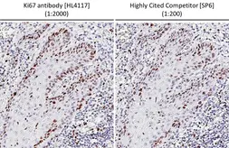 Anti-Ki67 antibody [HL4117] used in IHC (Paraffin sections) (IHC-P). GTX642563