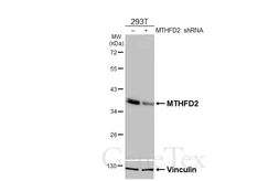 Anti-MTHFD2 antibody [HL4200] used in Western Blot (WB). GTX643023