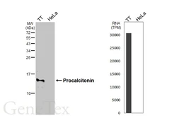 Anti-Procalcitonin antibody [HL4214] used in Western Blot (WB). GTX643036