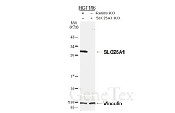 Anti-SLC25A1 antibody [HL4227] used in Western Blot (WB). GTX643060