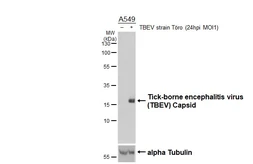 Anti-Tick-borne encephalitis virus (TBEV) Capsid antibody [HL4289] used in Western Blot (WB). GTX643529