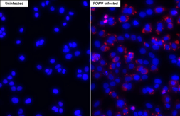Anti-Powassan virus NS4B antibody [HL4298] used in Immunocytochemistry/ Immunofluorescence (ICC/IF). GTX643538