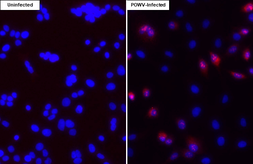 Anti-Powassan virus Capsid antibody [HL4301] used in Immunocytochemistry/ Immunofluorescence (ICC/IF). GTX643541