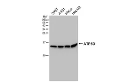 Anti-ATP5D antibody [HL4372] used in Western Blot (WB). GTX643629