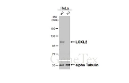Anti-LOXL2 antibody [HL4379] used in Western Blot (WB). GTX643636