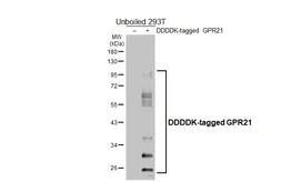 Anti-GPR21 antibody [HL4426] used in Western Blot (WB). GTX643715