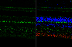 Anti-mGluR6 antibody [HL4469] used in IHC (Paraffin sections) (IHC-P). GTX644034