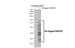 Anti-NMUR2 antibody [HL4522] used in Western Blot (WB). GTX644092