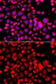 Anti-Eotaxin antibody used in Immunocytochemistry/ Immunofluorescence (ICC/IF). GTX64437