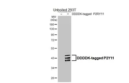 Anti-P2Y11 antibody [HL4748] used in Western Blot (WB). GTX644752