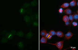 Anti-Aurora B antibody [HL4798] used in Immunocytochemistry/ Immunofluorescence (ICC/IF). GTX644810